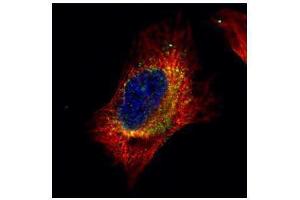 ICC/IF Image Confocal immunofluorescence analysis (Olympus FV10i) of paraformaldehyde-fixed HeLa, using Cofilin 2 (muscle), antibody (Green) at 1:500 dilution. (Cofilin 2 antibody)