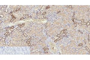 Immunohistochemistry of paraffin-embedded Human kidney tissue using Cleaved-CASP8 (D384) Polyclonal Antibody at dilution of 1:200. (Caspase 8 antibody  (Cleaved-Asp384))