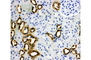 Anti-PBP antibody, IHC(P) IHC(P): Rat Kidney Tissue (PEBP1 antibody  (N-Term))