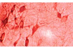 Immunohistochemistry analysis using Rabbit Anti-HO-1 Polyclonal Antibody . (HMOX1 antibody  (HRP))