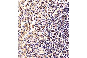 Immunohistochemical analysis of paraffin-embedded H. (beta Actin antibody)