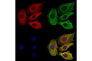 ABIN6265108 and ABIN6273319 staining Hela cells by IF/ICC. (SLC13A2 antibody  (Internal Region))