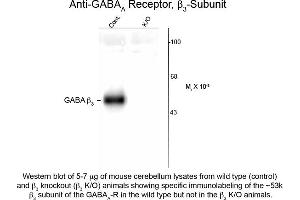 Western blot of GABAA Receptor ß3 Antibody Western Blot of Rabbit anti-GABAA Receptor ß3 Antibody. (GABRB3 antibody  (Cytoplasmic Loop))