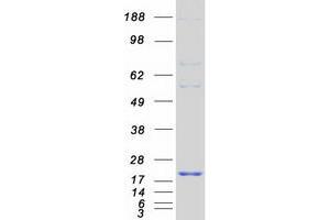Leucine Zipper, Down-Regulated in Cancer 1 (LDOC1) protein (Myc-DYKDDDDK Tag)