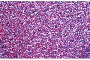 Human Tonsil: Formalin-Fixed, Paraffin-Embedded (FFPE) (MARCKS antibody  (AA 2-66))