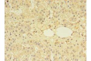 Immunohistochemistry of paraffin-embedded human adrenal gland tissue using ABIN7159585 at dilution of 1:100 (MTR antibody  (AA 923-1265))