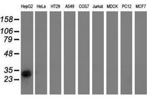 Western blot analysis of extracts (35 µg) from 9 different cell lines by using anti-RASD2 monoclonal antibody. (RASD2 antibody)