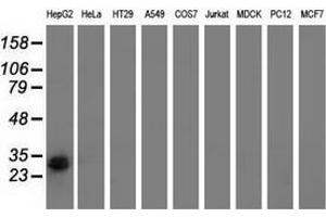Western blot analysis of extracts (35 µg) from 9 different cell lines by using anti-RASD2 monoclonal antibody.