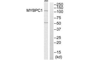 Western Blotting (WB) image for anti-Myosin Binding Protein C, Slow Type (MYBPC1) (Internal Region) antibody (ABIN1851618) (MYBPC1 antibody  (Internal Region))