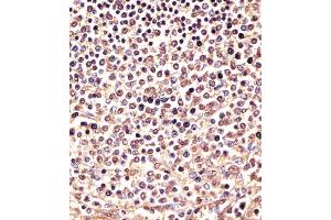 (ABIN6243739 and ABIN6577971) staining PSMB9 in human spleen sections by Immunohistochemistry (IHC-P - paraformaldehyde-fixed, paraffin-embedded sections). (PSMB9 antibody  (C-Term))
