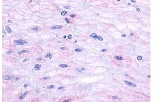Anti-Neurokinin A Receptor antibody  ABIN1049100 IHC staining of human small intestine, muscularis propria. (TACR2 antibody  (C-Term))