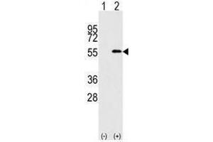 Image no. 1 for anti-Nucleoporin 50kDa (NUP50) (C-Term) antibody (ABIN357219) (NUP50 antibody  (C-Term))