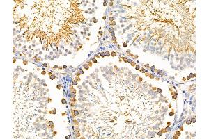 ABIN6256941 and ABIN6274588 at 1/100 staining Rat testis tissue by IHC-P. (beta Arrestin 1 antibody  (C-Term))