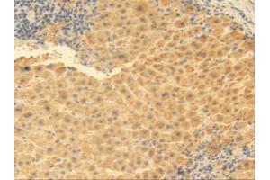 IHC-P analysis of Human Liver Tissue, with DAB staining. (MGP antibody  (AA 1-103))