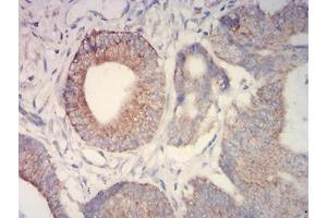 Immunohistochemistry (IHC) image for anti-Isocitrate Dehydrogenase 2 (NADP+), Mitochondrial (IDH2) (AA 1-143) antibody (ABIN7193379)