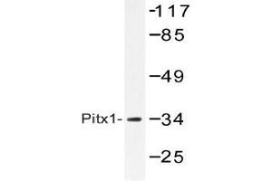 Western blot (WB) analysis of Pitx1 antibody in extracts from Jurkat cells. (PITX1 antibody)