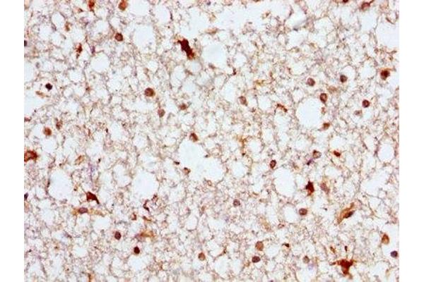 Aspartate beta Hydroxylase antibody  (AA 75-270)