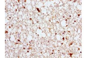 IHC image of ABIN7144757 diluted at 1:300 and staining in paraffin-embedded human brain tissue performed on a Leica BondTM system. (Aspartate beta Hydroxylase antibody  (AA 75-270))