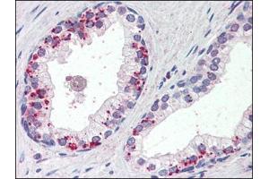 Human Prostate (formalin-fixed, paraffin-embedded) stained with ANXA1at 4 µg/ml followed by biotinylated anti-goat IgG secondary antibody, alkaline phosphatase-streptavidin and chromogen. (Annexin a1 antibody  (C-Term))