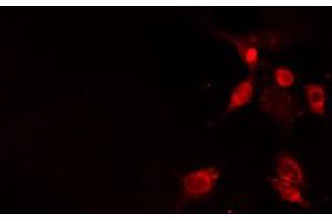 ABIN6272360 staining Hela by IF/ICC. (NFATC2IP antibody  (Internal Region))