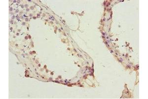 Immunohistochemistry of paraffin-embedded human testis tissue using ABIN7156130 at dilution of 1:100 (KPNA5 antibody  (AA 1-240))