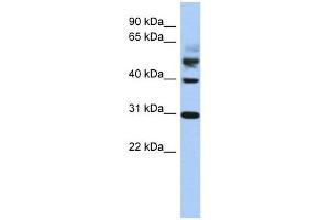 TTL antibody used at 1 ug/ml to detect target protein. (TTL antibody  (Middle Region))