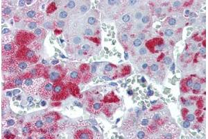 Human Adrenal (formalin-fixed, paraffin-embedded) stained with M6PRBP1 antibody ABIN351437 at 5 ug/ml followed by biotinylated goat anti-rabbit IgG secondary antibody ABIN481713, alkaline phosphatase-streptavidin and chromogen. (PLIN3 antibody  (N-Term))