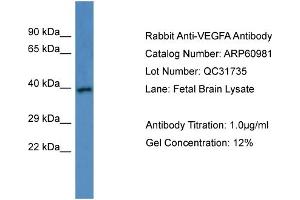 Western Blotting (WB) image for anti-Vascular Endothelial Growth Factor A (VEGFA) (C-Term) antibody (ABIN2788641) (VEGFA antibody  (C-Term))