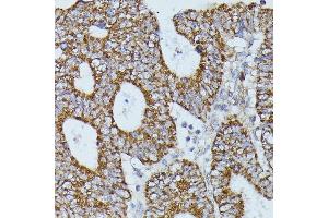 Immunohistochemistry (IHC) image for anti-Flightless I Homolog (FLII) (AA 400-660) antibody (ABIN7267217)