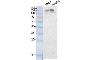 Western Blotting (WB) image for anti-Nuclear Receptor Coactivator 3 (NCOA3) (Internal Region) antibody (ABIN3187987) (NCOA3 antibody  (Internal Region))