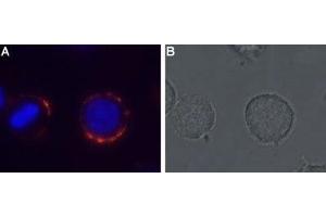 Expression of MC4R in rat pituitary cell line - Cell surface detection of MC4R in live intact GH3 cells with Anti-MC4 Receptor (extracellular) Antibody (ABIN7043324, ABIN7044596 and ABIN7044597), (1:50). (MC4R antibody  (Extracellular, N-Term))