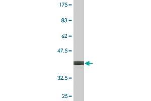 Western Blot detection against Immunogen (37. (SF3B4 antibody  (AA 13-122))