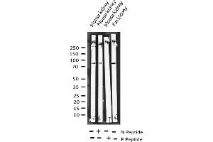 Western blot analysis of Phospho-Tau (Ser422) expression in various lysates (MAPT antibody  (pSer422))