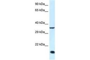 Image no. 1 for anti-Kruppel-Like Factor 3 (Basic) (KLF3) (C-Term) antibody (ABIN6747432)
