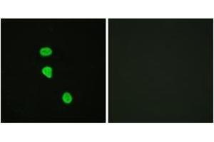 Immunofluorescence analysis of HeLa cells, using AS160 (Phospho-Thr642) Antibody. (TBC1D4 antibody  (pThr642))