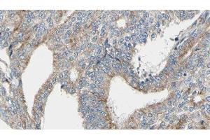 ABIN6276352 at 1/100 staining Human prostate tissue by IHC-P. (TUBA4A antibody  (N-Term))