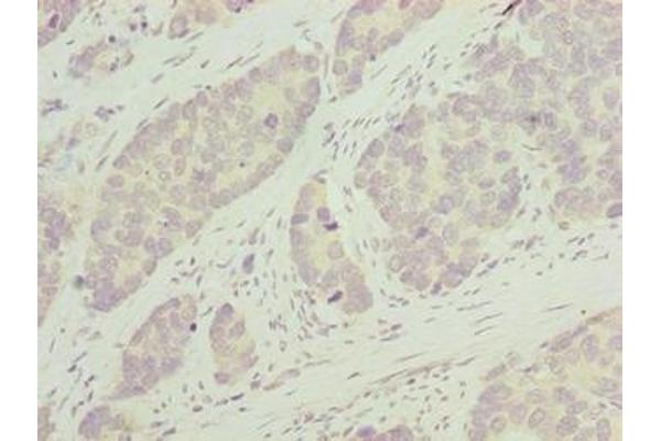 GNRPX antibody  (AA 1-149)