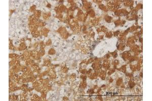 Immunoperoxidase of monoclonal antibody to FOXO1A on formalin-fixed paraffin-embedded human liver. (FOXO1 antibody  (AA 452-555))
