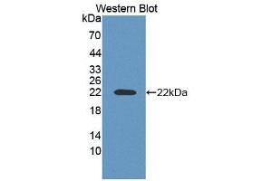 Western blot analysis of the recombinant protein. (ACD antibody  (AA 147-342))