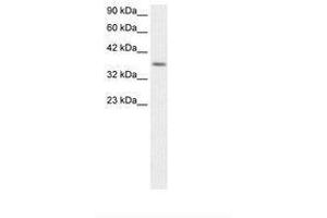 Image no. 1 for anti-Ribosomal Protein S16 (RPS16) (AA 92-139) antibody (ABIN202390) (RPS16 antibody  (AA 92-139))