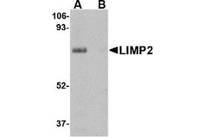 Western Blotting (WB) image for anti-Scavenger Receptor Class B, Member 2 (SCARB2) (Middle Region) antibody (ABIN1030987) (SCARB2 antibody  (Middle Region))