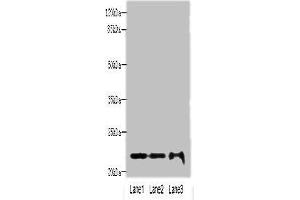 Western blot All lanes: MRPS18A antibody at 6 μg/mL Lane 1: HL60 whole cell lysate Lane 2: A549 whole cell lysate Lane 3: HepG2 whole cell lysate Secondary Goat polyclonal to rabbit IgG at 1/10000 dilution Predicted band size: 23, 31, 15 kDa Observed band size: 23 kDa (MRPS18A antibody  (AA 1-196))