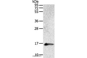Western blot analysis of Human fetal brain tissue, using PVALB Polyclonal Antibody at dilution of 1:400 (PVALB antibody)