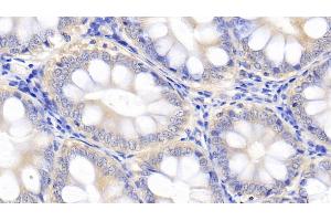 Detection of IL10 in Canine Colon Tissue using Polyclonal Antibody to Interleukin 10 (IL10) (IL-10 antibody  (AA 21-181))