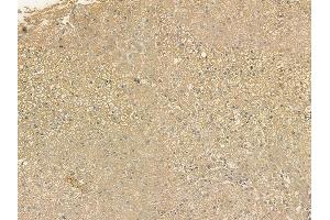 ABIN6256326 and ABIN6267207 at 1/100 staining human normal liver tissue by IHC-P. (WIPI2 antibody  (pSer413))