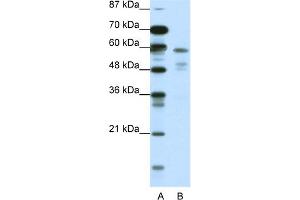 WB Suggested Anti-NR1H3 Antibody Titration:  2.