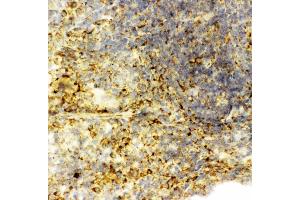Anti-Caspase-6(P18) antibody, IHC(F): Rat Spleen Tissue (Caspase 6 antibody  (N-Term))