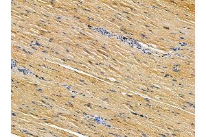 ABIN7095493 and ABIN7099550 at 1/100 staining rat muscle tissue by IHC-P. (Phosphoglucomutase 3 antibody)