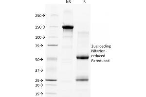 SDS-PAGE Analysis Purified CD28 Mouse Monoclonal Antibody (C28/77).