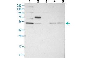Western blot analysis of Lane 1: RT-4, Lane 2: U-251 MG, Lane 3: Human Plasma, Lane 4: Liver, Lane 5: Tonsil with CDCA7L polyclonal antibody  at 1:250-1:500 dilution.